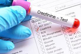 Creatinine test cost: What does this test tell about your kidney health?